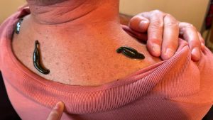 Medicinal leech therapy training and education